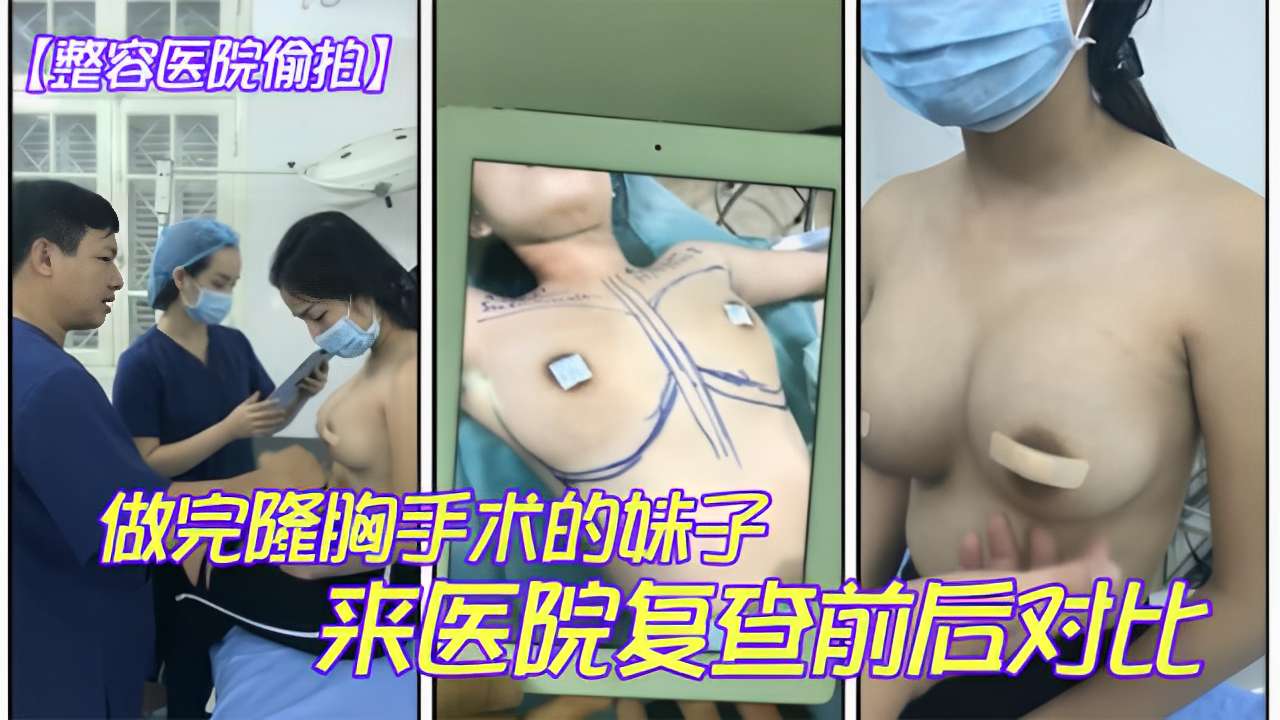 [整容医院偷拍]做完隆胸手术的妹子来医院复查前后对比